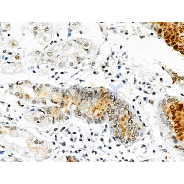 Phospho-TOPBP1 (Ser1138) Antibody -AF3564