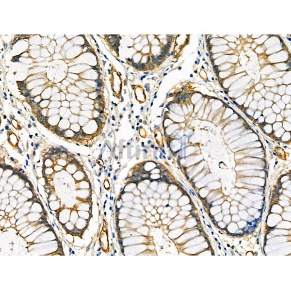 Phospho-BLNK (Tyr84) Antibody -AF3566