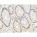 Phospho-MLKL (Ser345) Antibody -AF3568