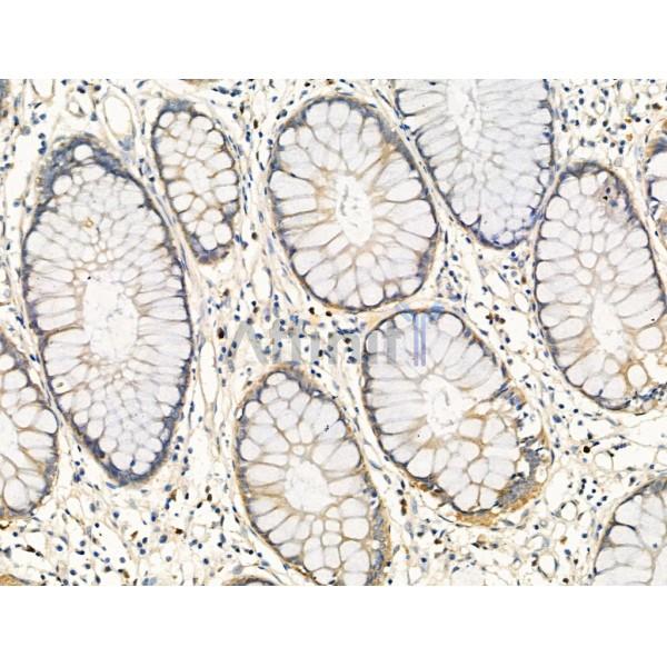 Phospho-MLKL (Ser345) Antibody -AF3568