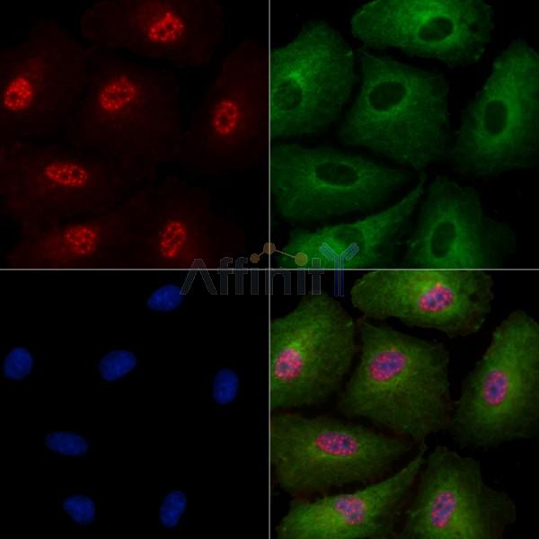 Phospho-SIRT6 (Thr294) Antibody -AF3571