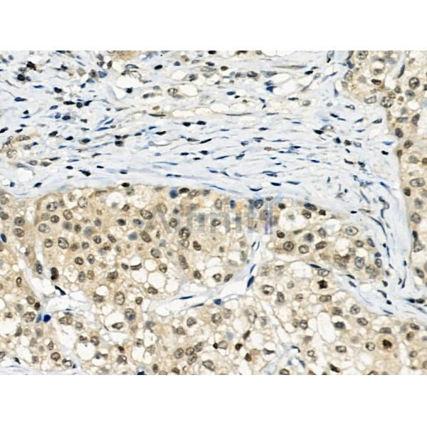 Phospho-TORC2 (Ser275) Antibody -AF3579