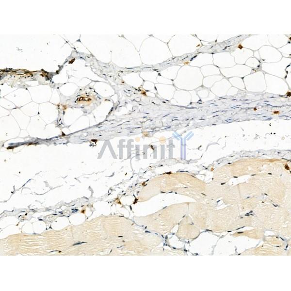 Phospho-PFKFB3 (Ser461) Antibody -AF3581