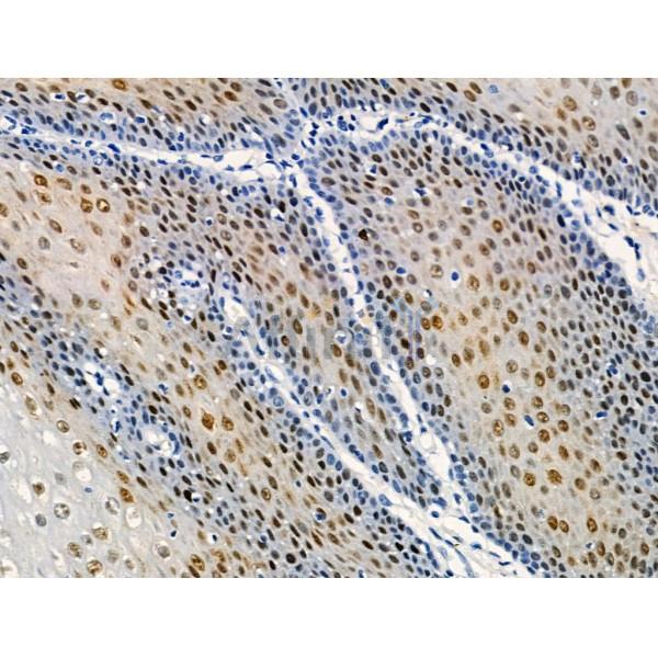 Phospho-EZH2 (Thr416) Antibody -AF3585