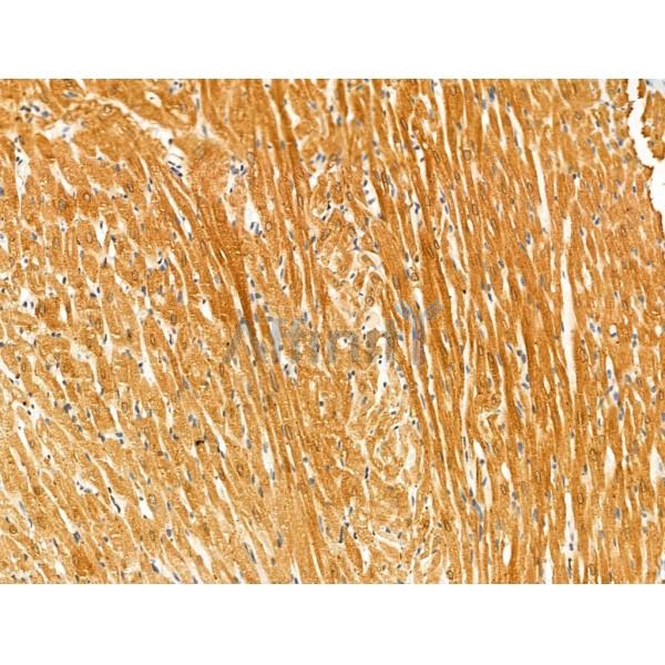 Phospho-Kir6.2 (Thr224) Antibody -AF3590