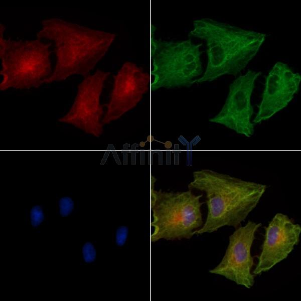 Phospho-IP3 Receptor (Ser1764) Antibody -AF3592