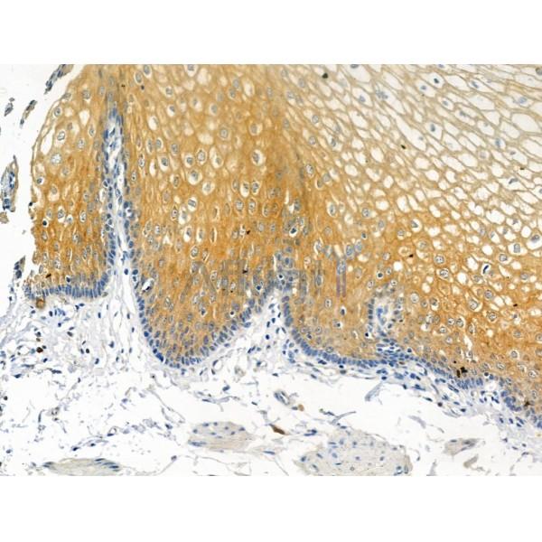 Phospho-Beclin 1 (Ser295) Antibody -AF3593