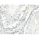 Phospho-PYK2 (Tyr881) Antibody -AF3595