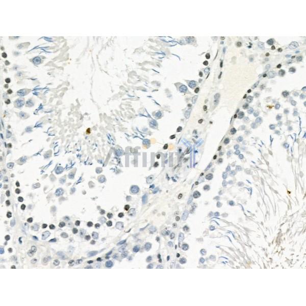 Phospho-PYK2 (Tyr881) Antibody -AF3595