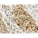 Phospho-RUNX2 (Ser319) Antibody -AF3596