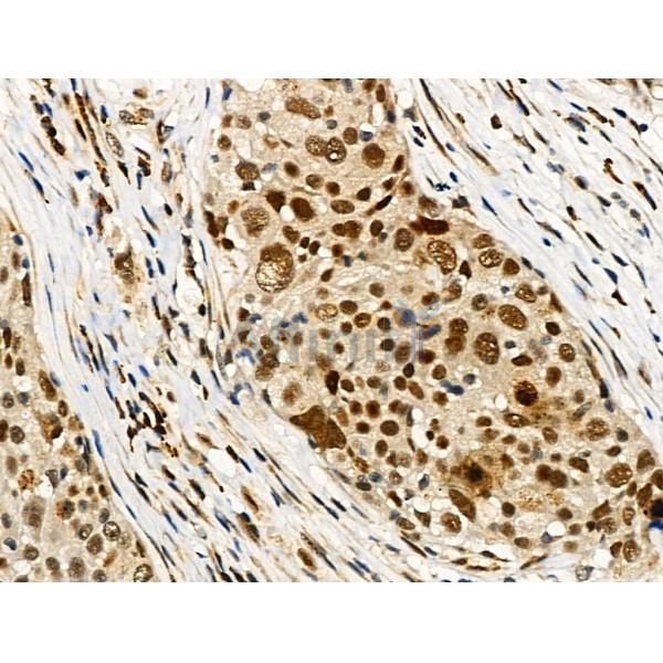 Phospho-RUNX2 (Ser319) Antibody -AF3596
