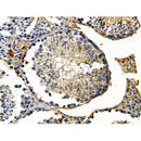 Phospho-DYR1A (Tyr449) Antibody -AF3598