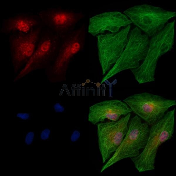 Phospho-IRF5 (Ser446) Antibody -AF3599