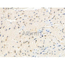 Phospho-ATM (Tyr370) Antibody -AF3603