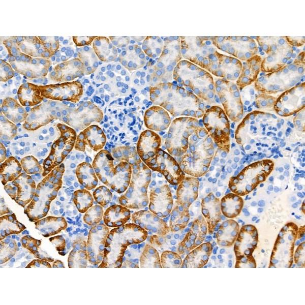 Phospho-MEKK1 (Thr1400) Antibody -AF3605
