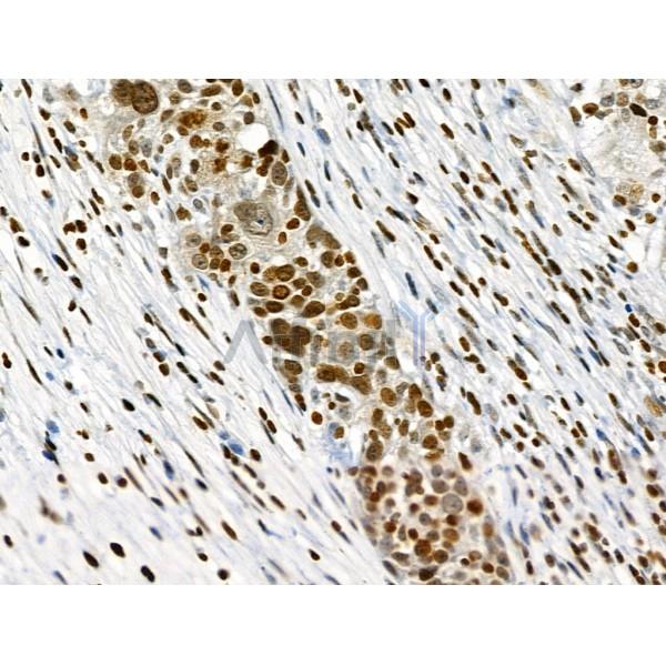 Phospho-PAK1 (Ser199) Antibody -AF3606