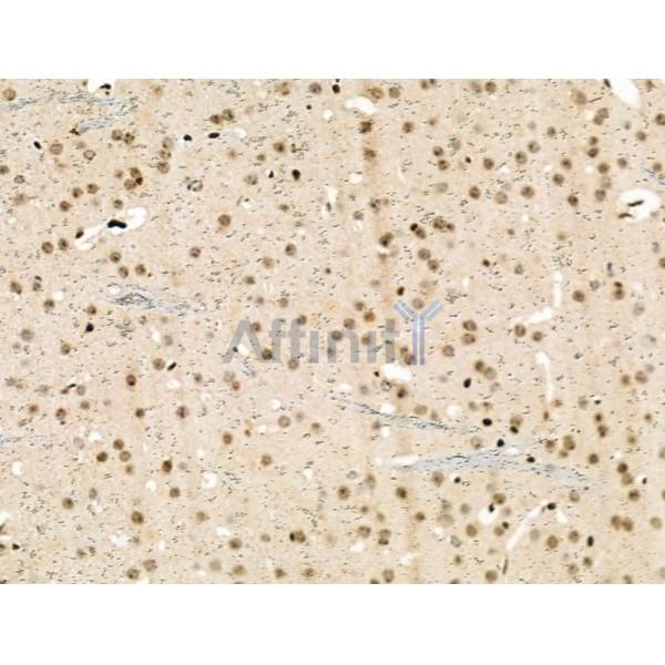 Phospho-NMDAR2A (Ser1155) Antibody -AF3610