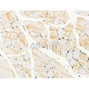 Phospho-ITK (Tyr180) Antibody -AF3611