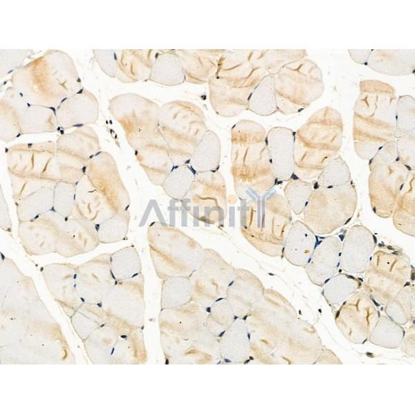 Phospho-ITK (Tyr180) Antibody -AF3611