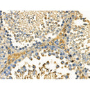 Phospho-DDR1 (Tyr180) Antibody -AF3612