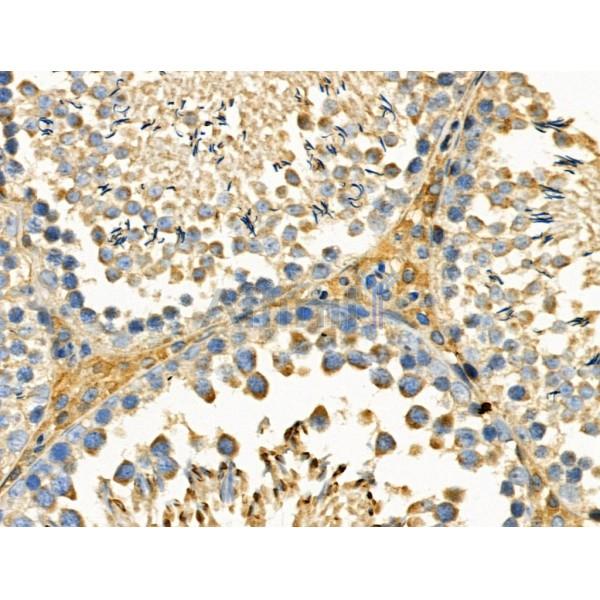 Phospho-DDR1 (Tyr180) Antibody -AF3612