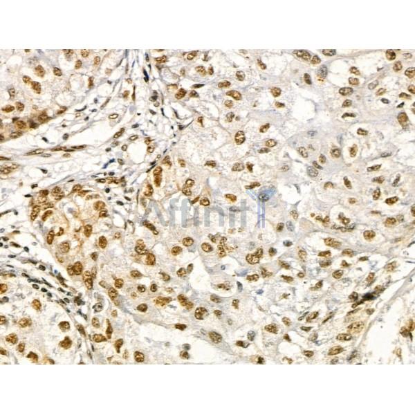 Phospho-EEF1A2 (Ser358) Antibody -AF3618