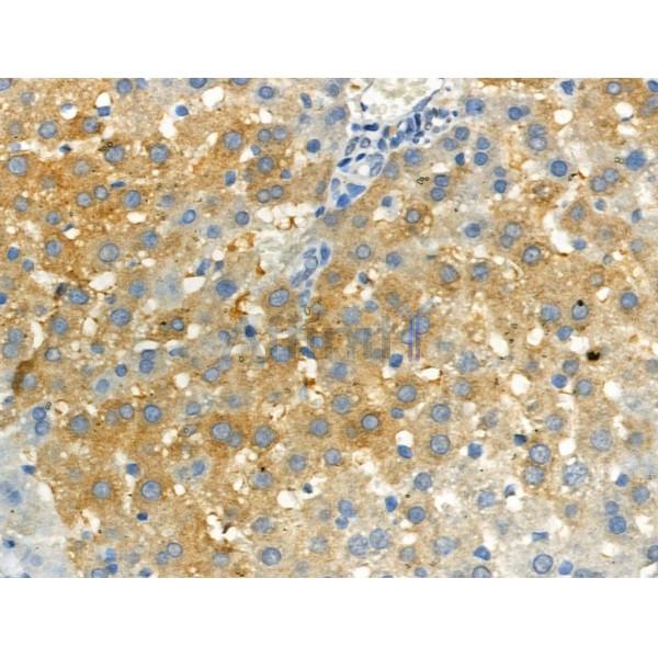 Phospho-RON (Ser1394) Antibody -AF3620
