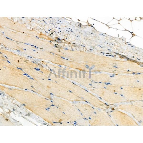 Phospho-PKC theta (Ser695) Antibody -AF3621