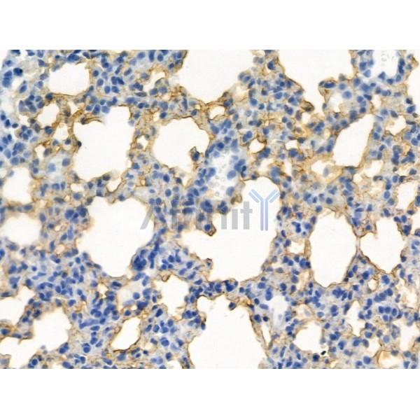 Phospho-CDK5 (Tyr239) Antibody -AF3628