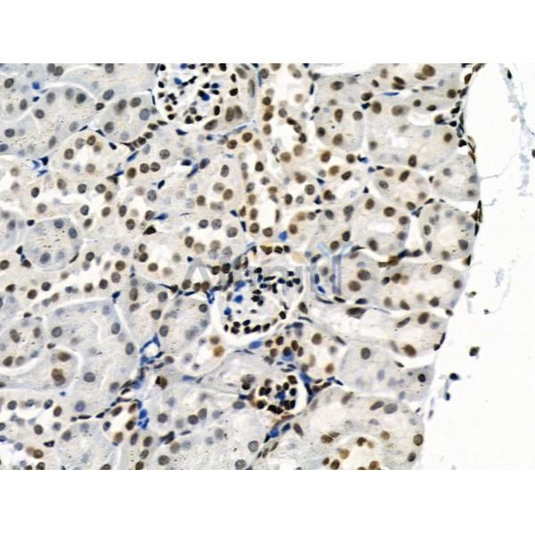 Phospho-SRPK2 (Thr492) Antibody -AF3632