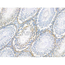 Phospho-PSD95 (Ser418) Antibody -AF3634