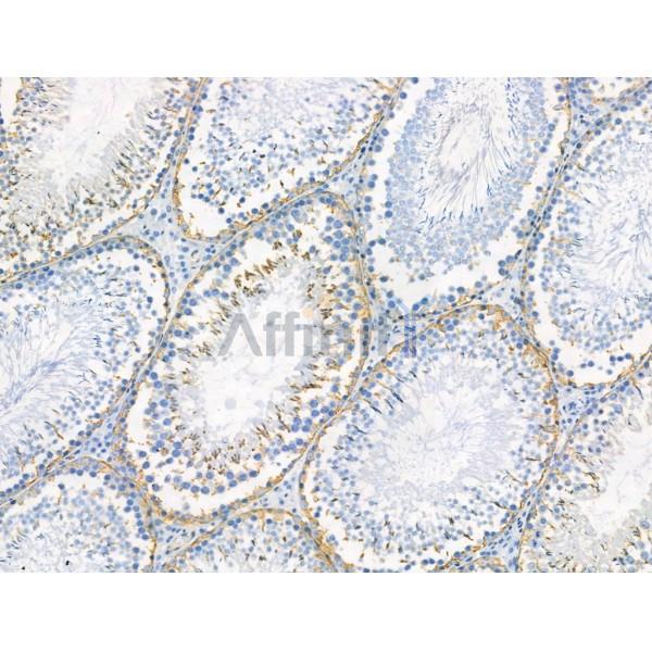 Phospho-PSD95 (Ser418) Antibody -AF3634