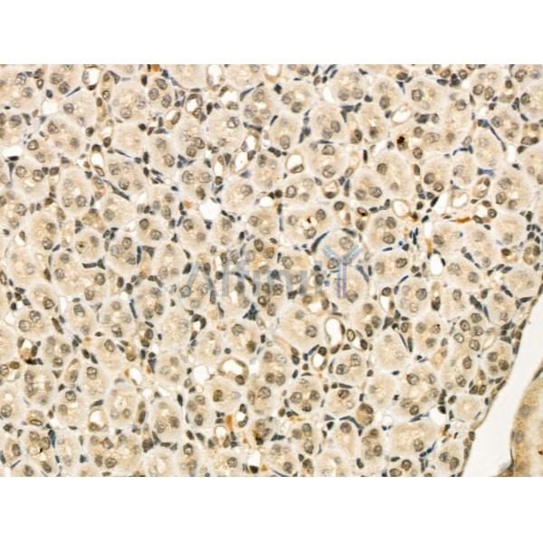 Phospho-YB1 (Ser102) Antibody -AF3635