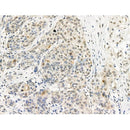 Phospho-PPP1CA (Thr320) Antibody -AF3638