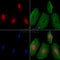 Phospho-hnRNP K (Ser216) Antibody -AF3639