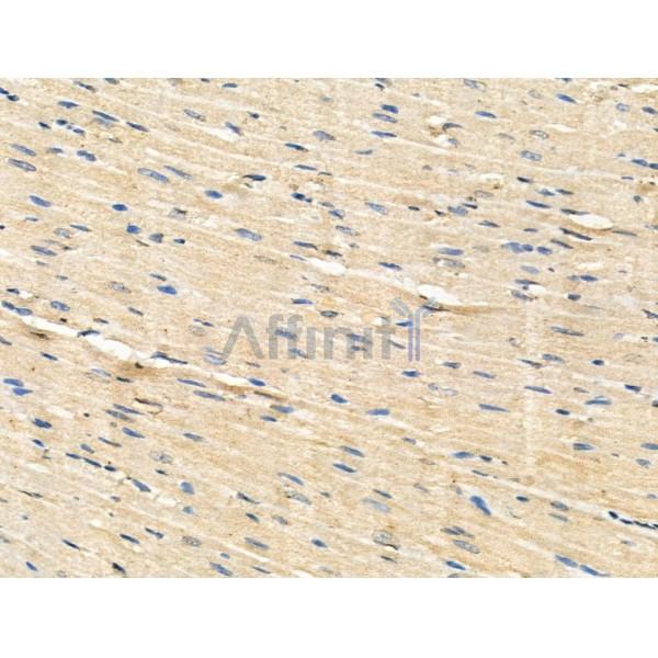 Phospho-CXCR4 (Ser339) Antibody -AF3642