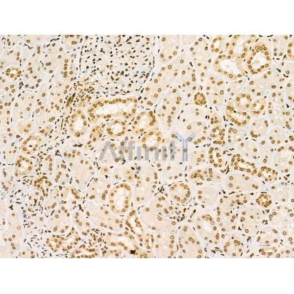 Phospho-Rab10 (Thr73) Antibody -AF3643