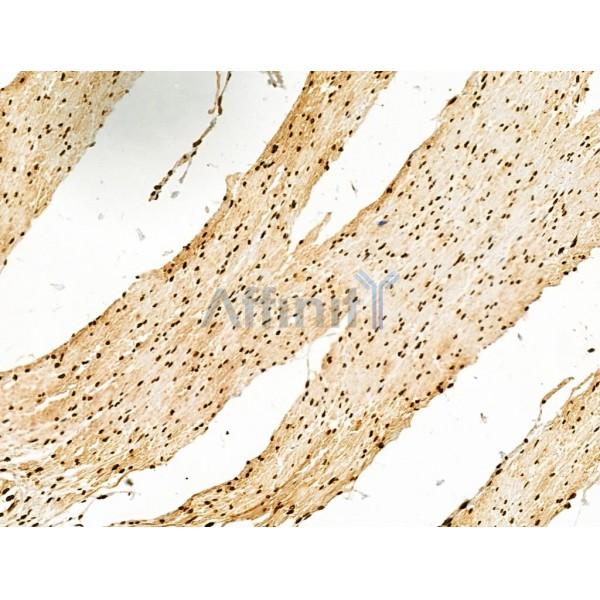 Phospho-Rab8 (Thr72) Antibody -AF3644