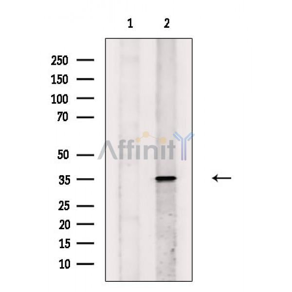 Phospho-TIRAP (Tyr106) Antibody -AF3648