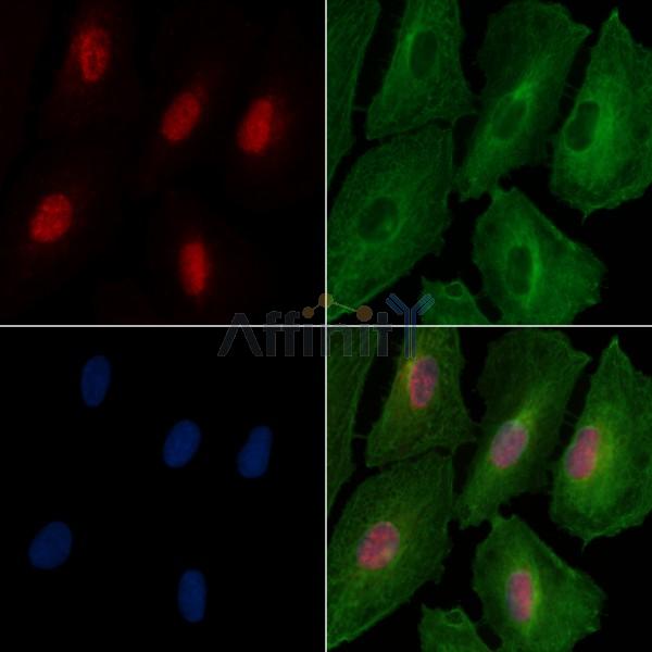 Phospho-FOXL2 (Ser263) Antibody -AF3649