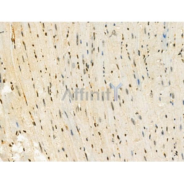 Phospho-MSH6 (Ser14) Antibody -AF3652