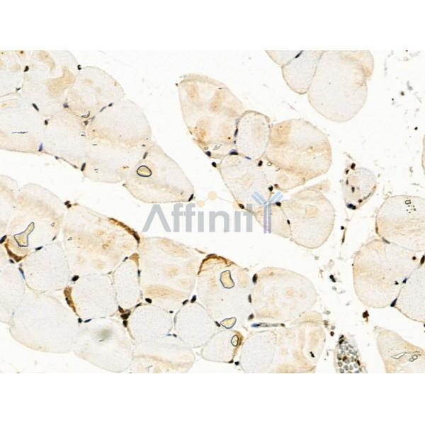 Phospho-STAT2 (Thr387) Antibody -AF3653
