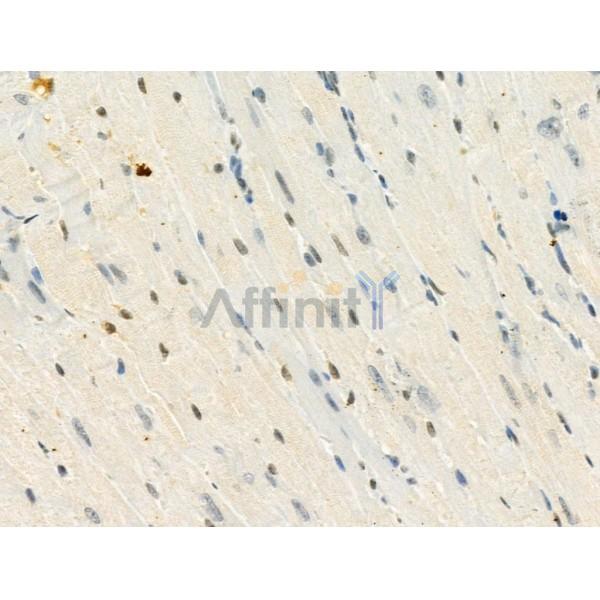 Phospho-MeCP2 (Ser423) Antibody -AF3656