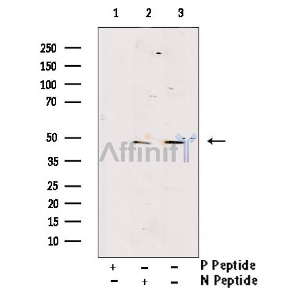 Phospho-GSK3 beta (Thr390) Antibody -AF3658