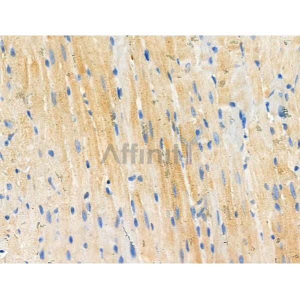 Phospho-Casein Kinase 1 alpha (Tyr294) Antibody -AF3660