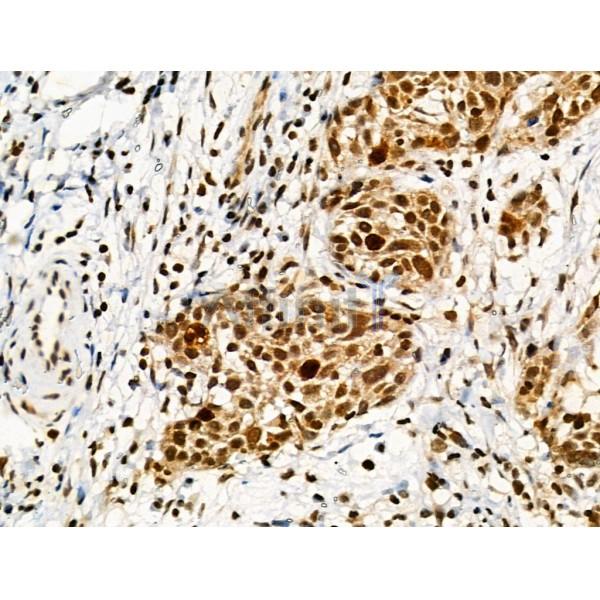 Phospho-Ki67 (Thr1335) Antibody -AF3665