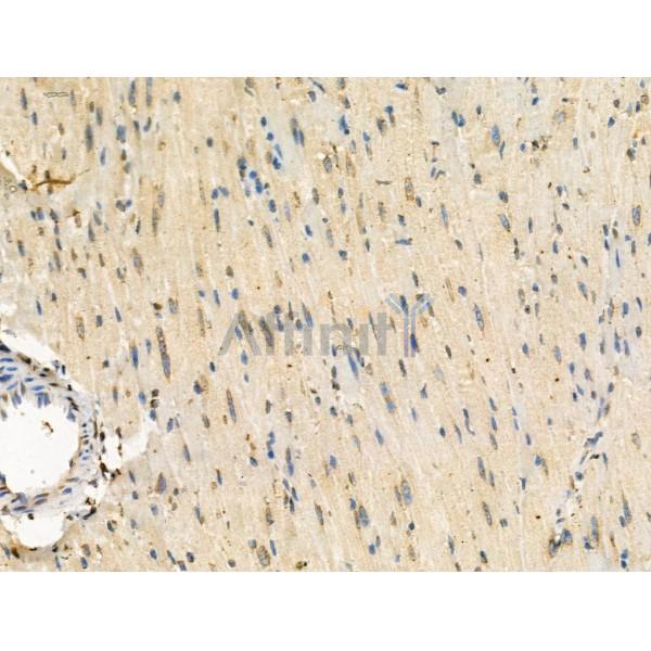 Phospho-MSH2 (Tyr238) Antibody -AF3666