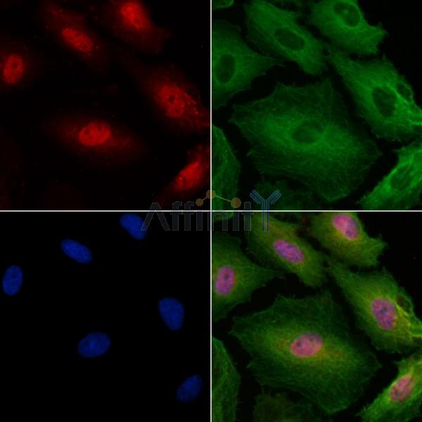 Phospho-CDKN2A/p16INK4a (Ser152) Antibody -AF3667