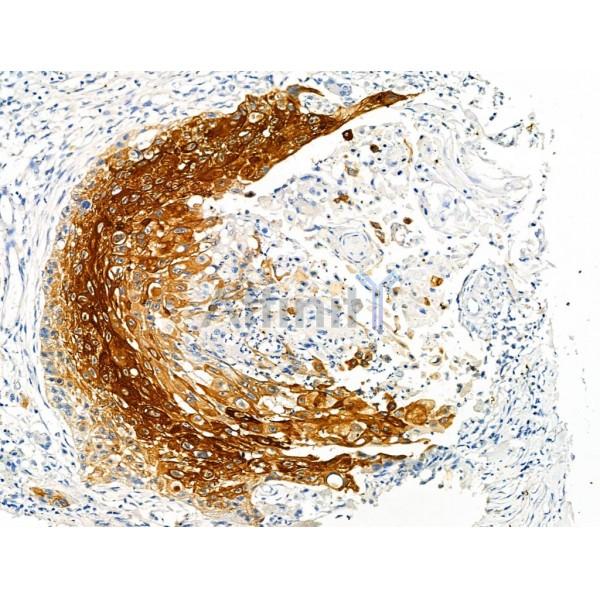 Phospho-MAP3K8/COT (Ser443) Antibody -AF3670