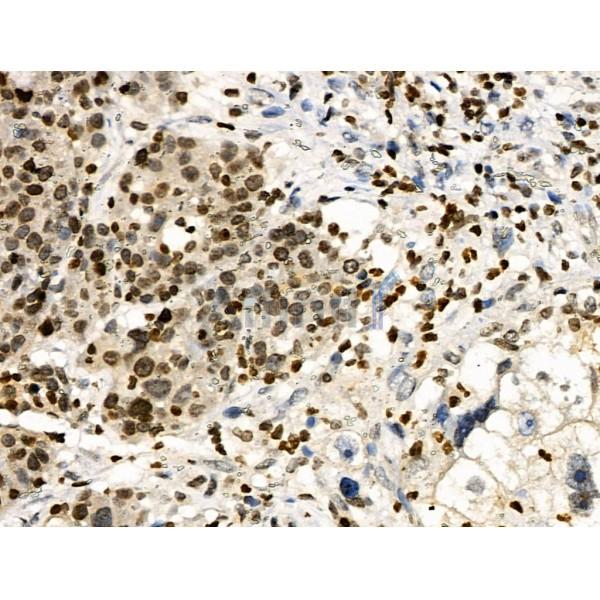 Phospho-HNF4 alpha (Ser304) Antibody -AF3671
